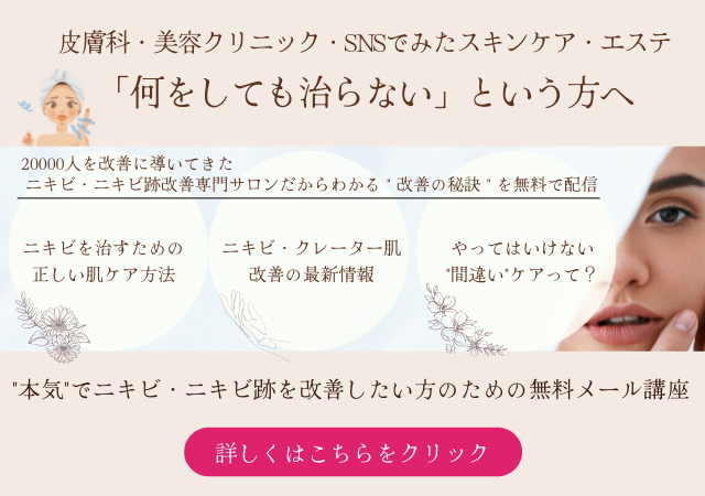 クレーター改善 集中プログラム
