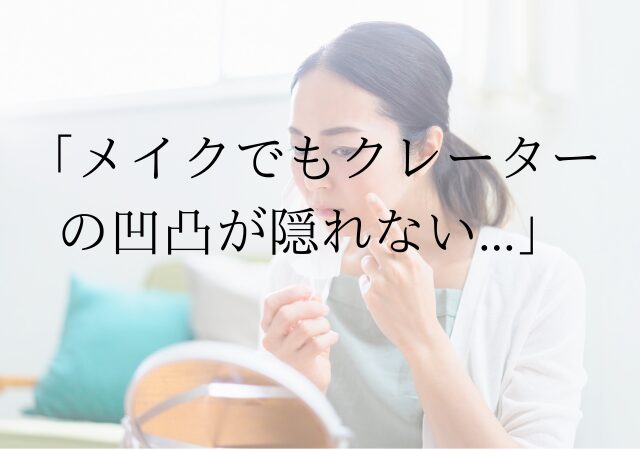 メイクでもクレーターの凹凸が隠れない