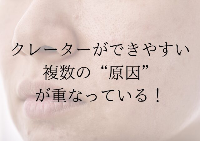 クレーターができやすい原因