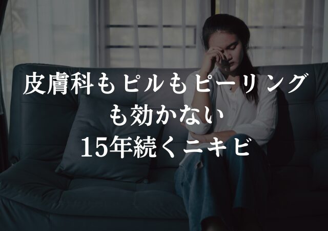皮膚科もピルもピーリングも効かないニキビ