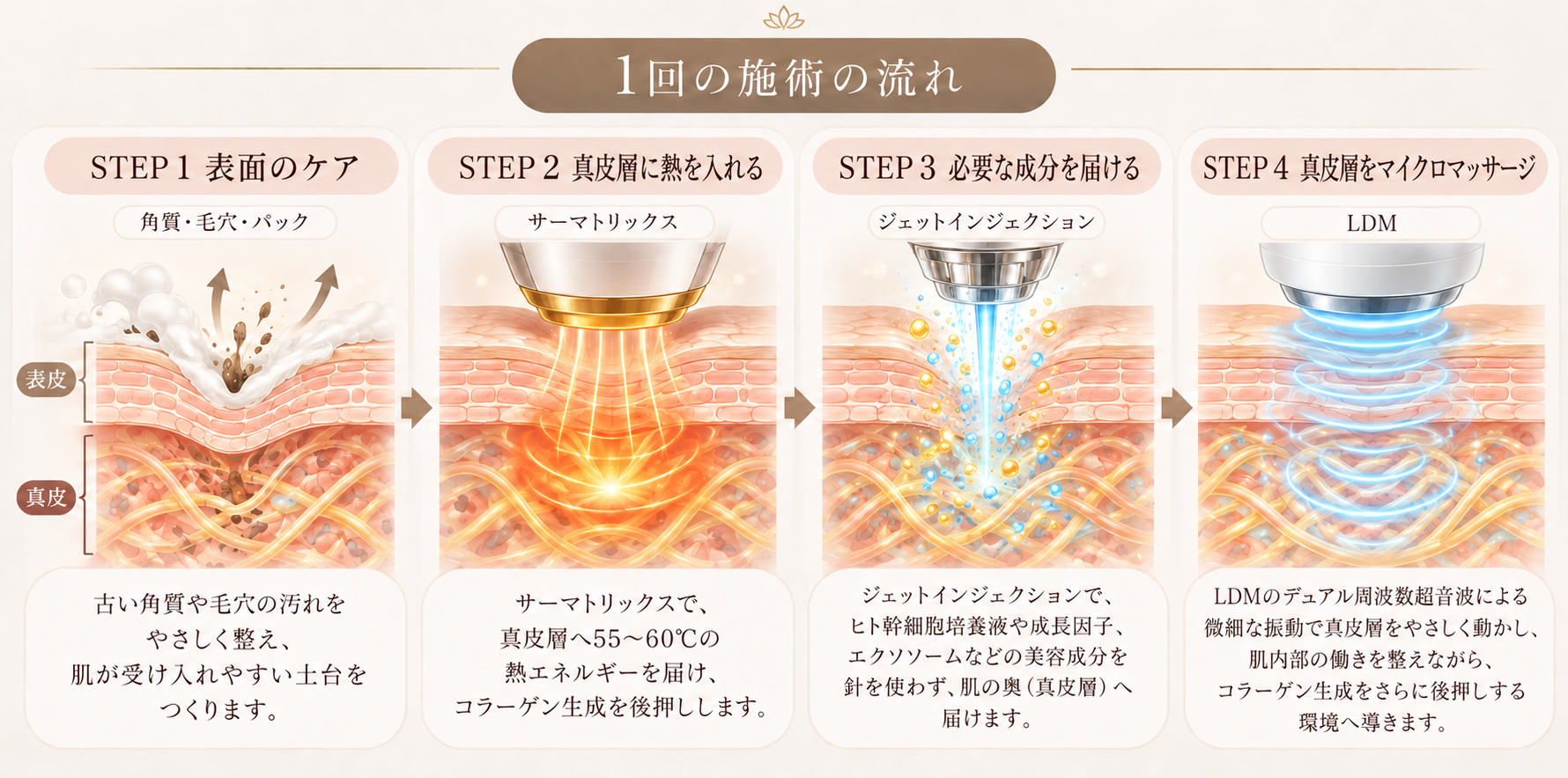 １回の施術の流れ　サーマトリックス、ジェットインジェクション、LDM