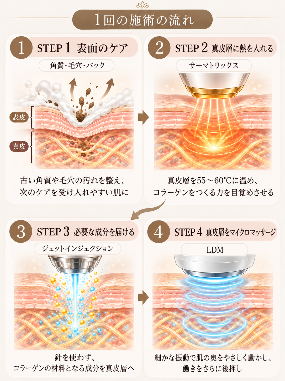 1回の施術の流れ 表面のケア、サーマトリックス、ジェットインジェクション、LDM